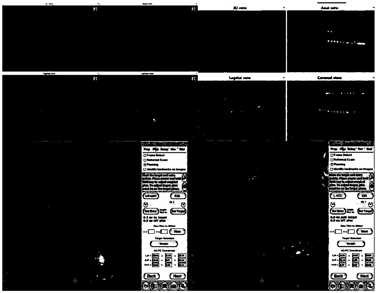 Method for manufacturing electrode gyrus scale map