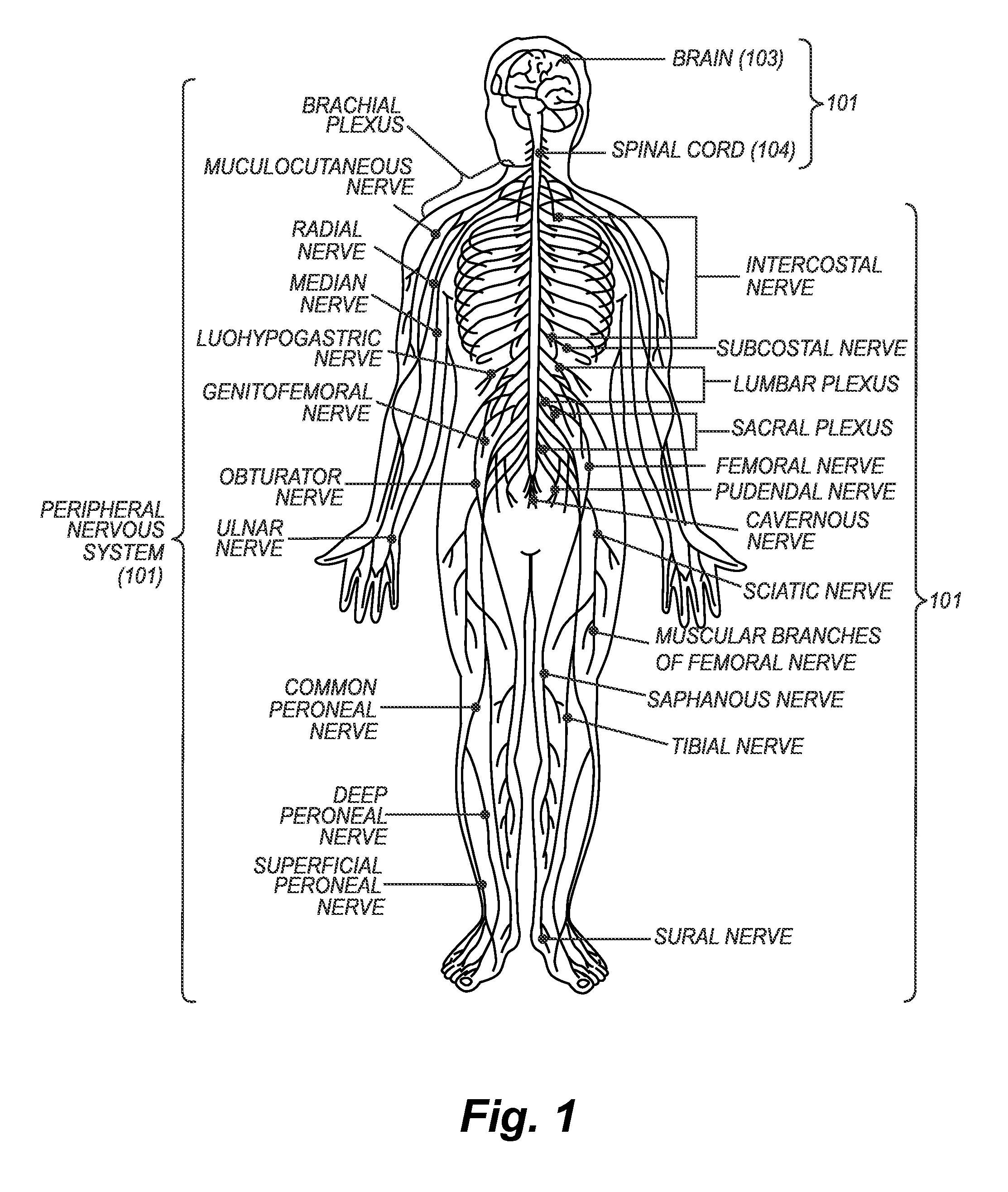 Enhancement of neural signal transmission through damaged neural tissue via hyperpolarizing electrical stimulation current