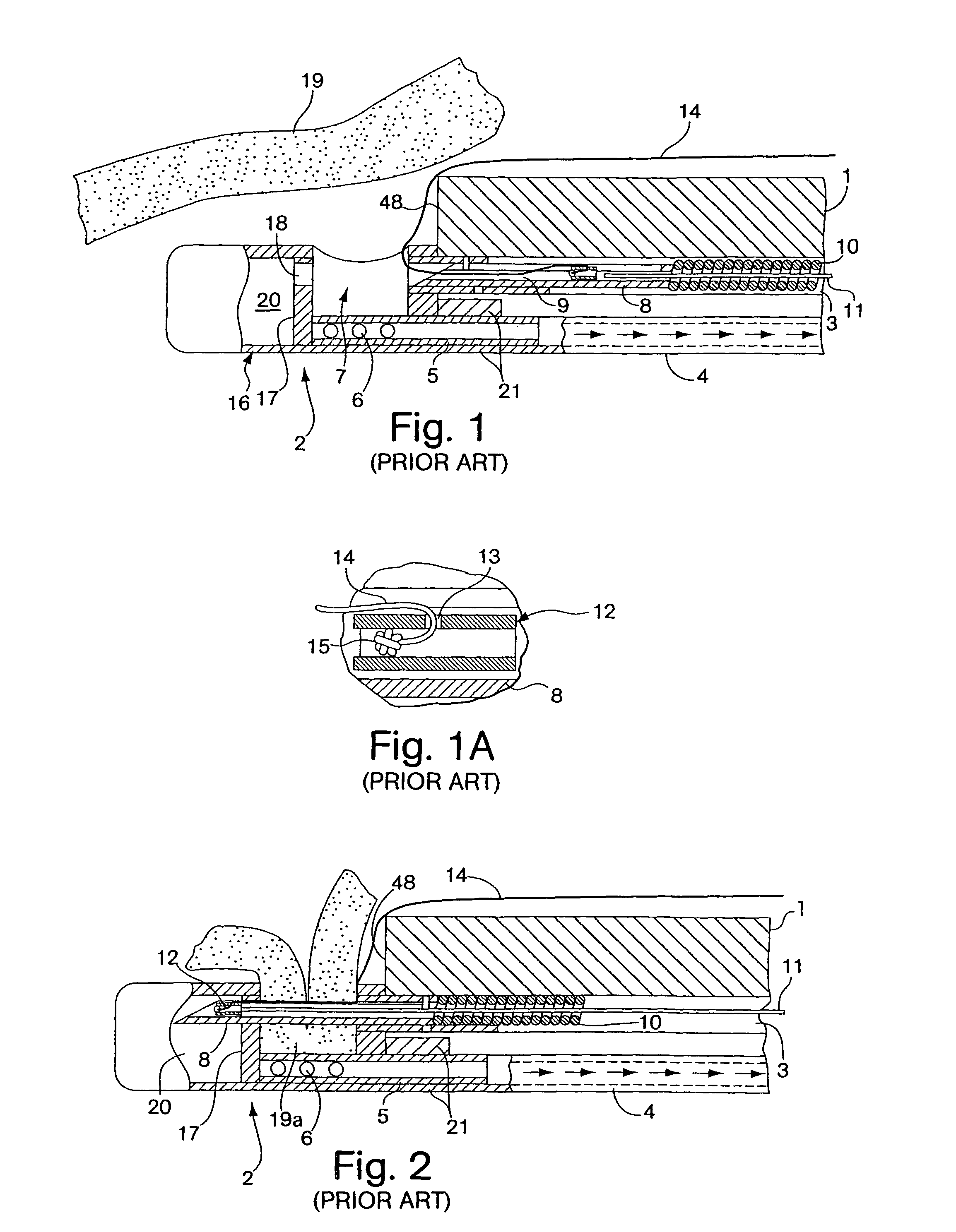 Integrated endoscope and accessory treatment device