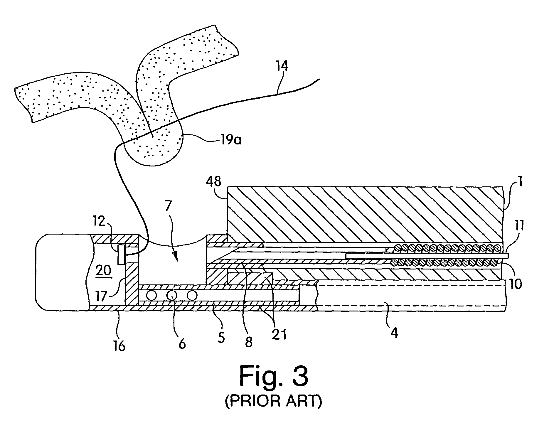 Integrated endoscope and accessory treatment device