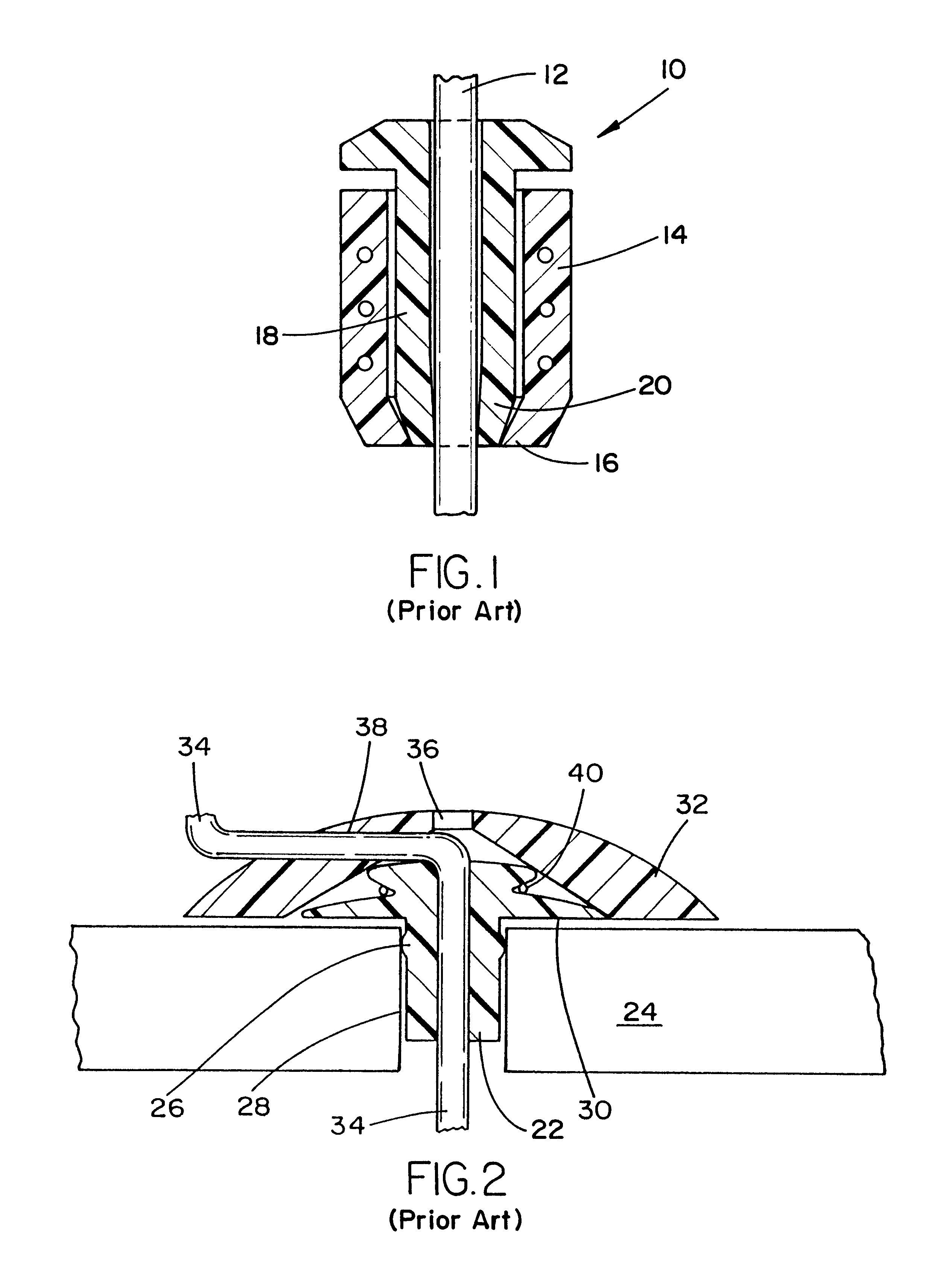 Skull mounted electrode lead securing assembly