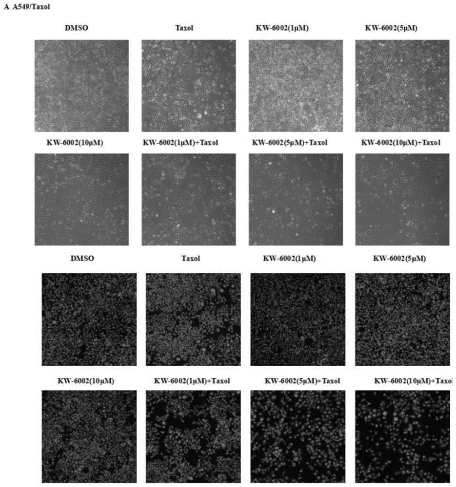 Pharmaceutical application of compound istradefylline for reversing drug resistance of paclitaxel