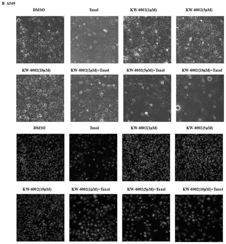 Pharmaceutical application of compound istradefylline for reversing drug resistance of paclitaxel