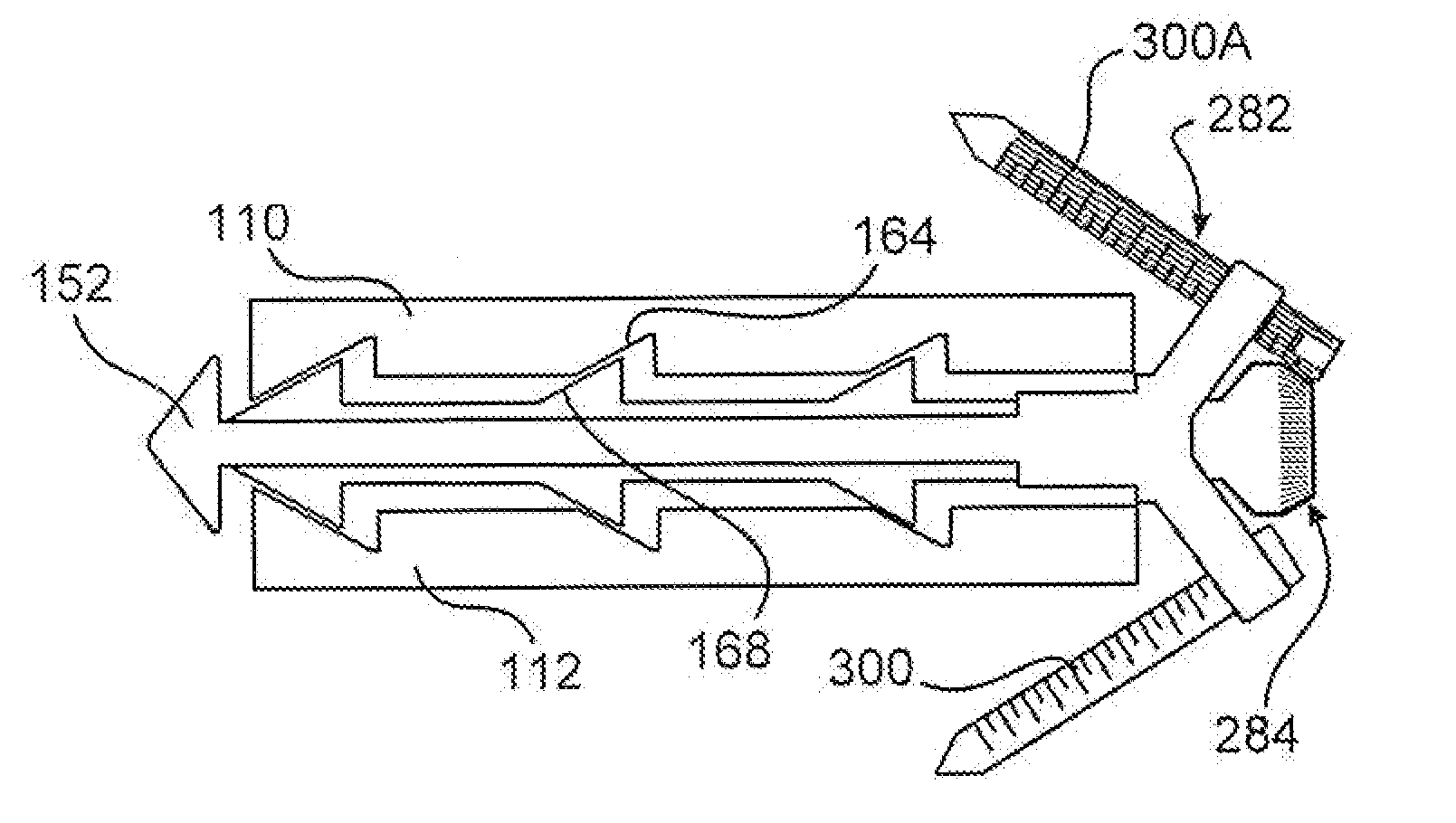 Expandable vertebral implant