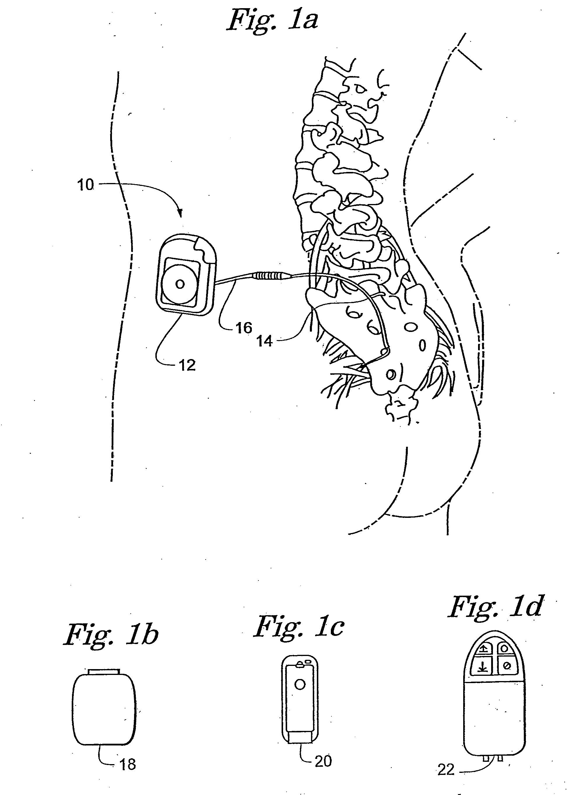 Implantable medical device configured for diagnostic emulation through serial communication