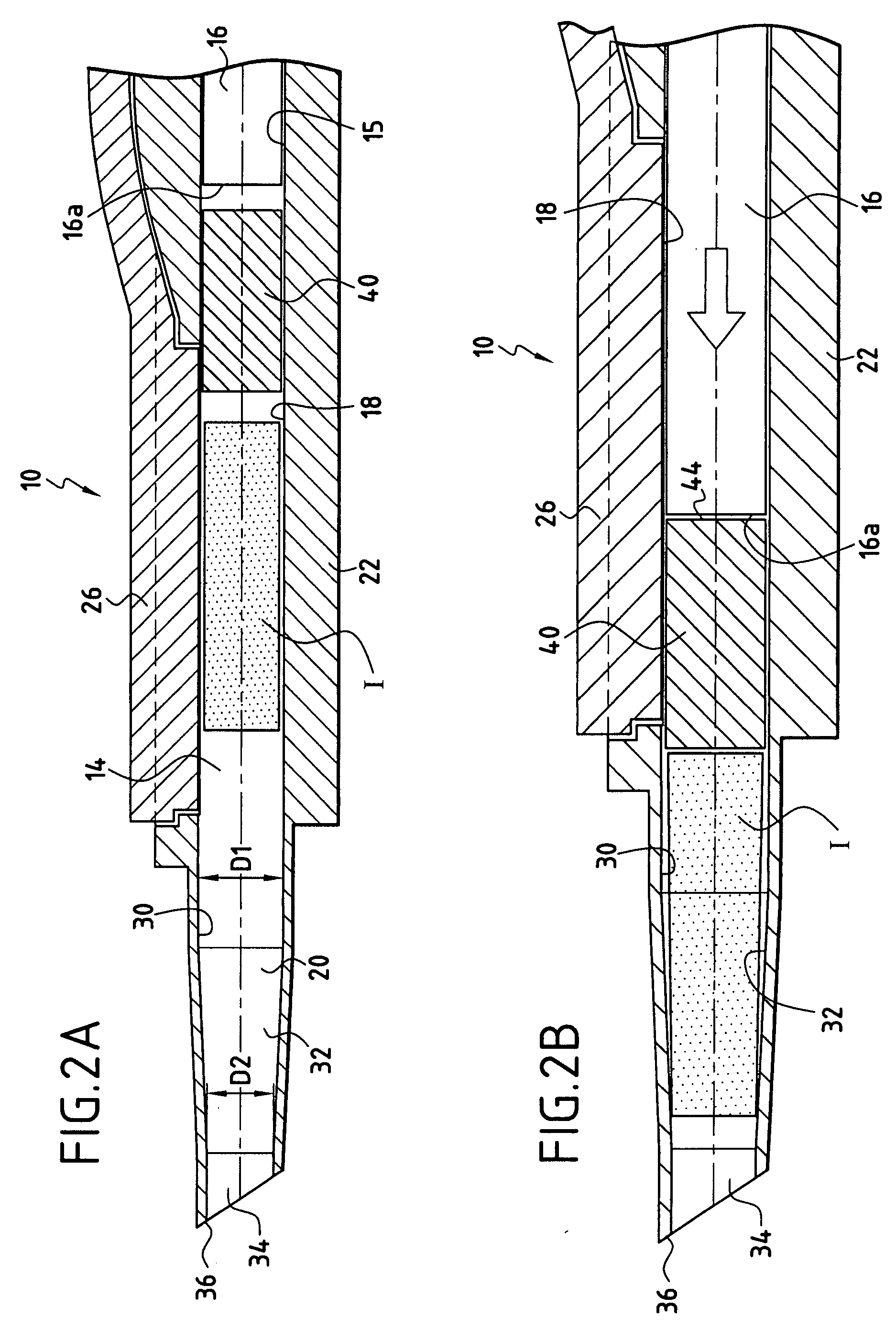 Flexible Intraocular Implant Injector