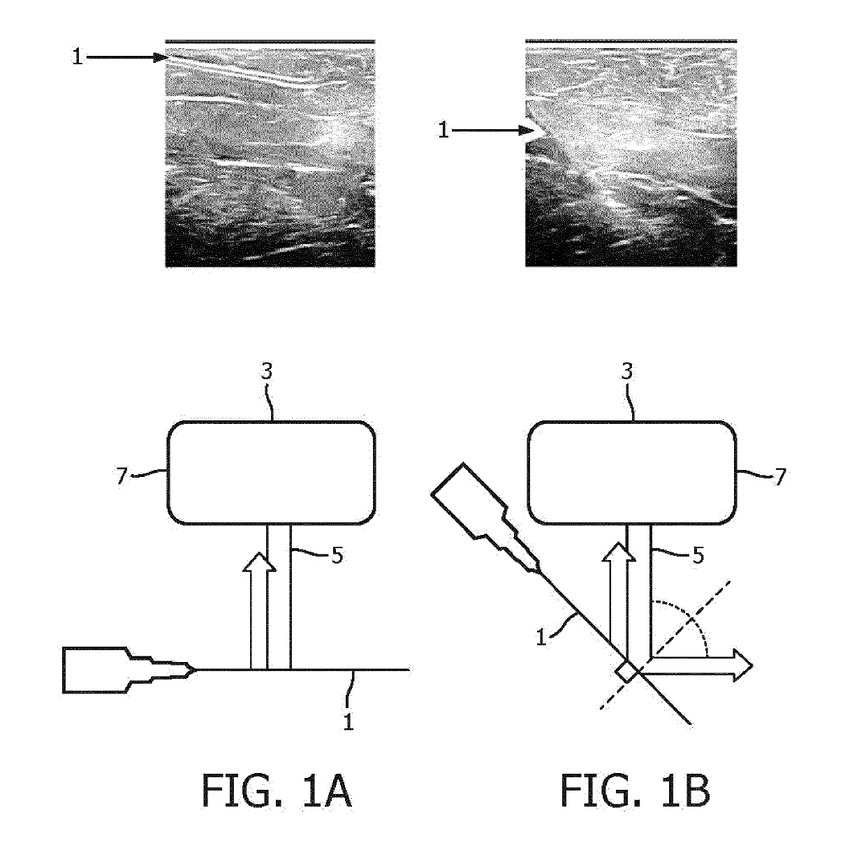 An apparatus and method for detecting an interventional tool