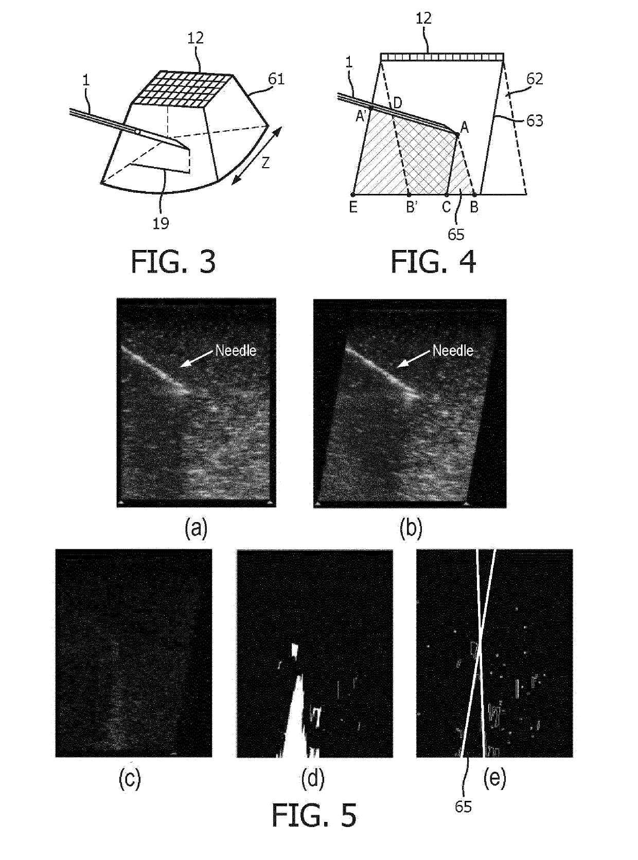 An apparatus and method for detecting an interventional tool