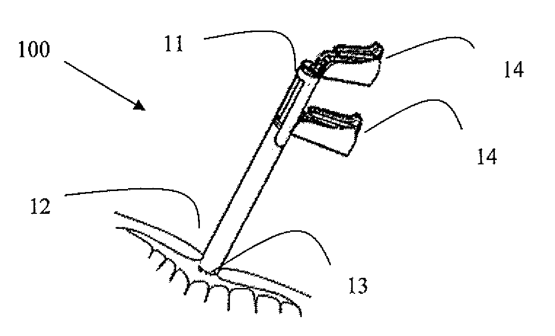 Device especially useful for hernia repair surgeries and methods thereof