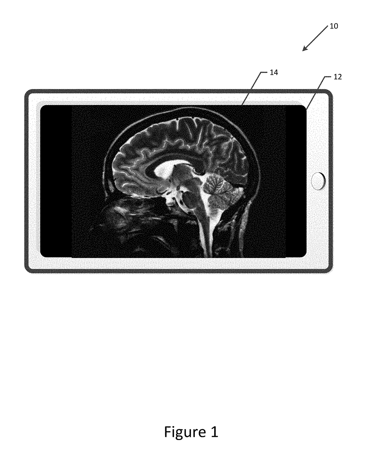 Method and computing device for window width and window level adjustment utilizing a multitouch user interface