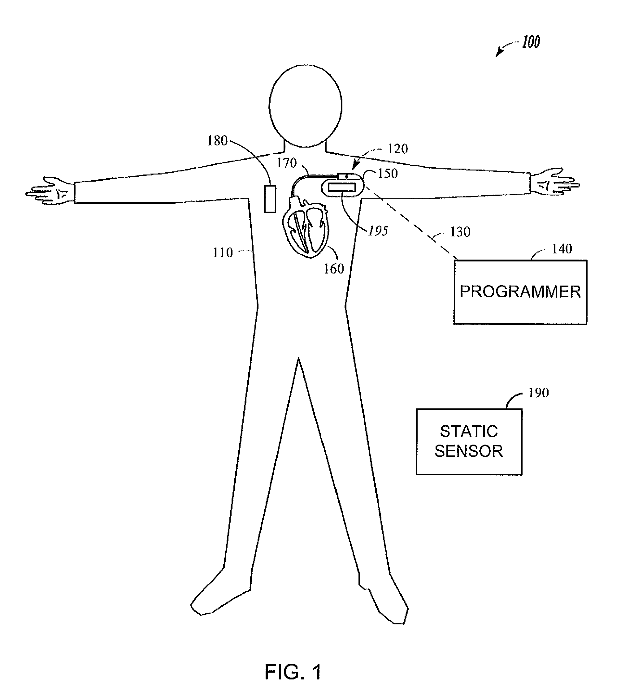 Detecting heart failure by monitoring the time seqence of physiological changes