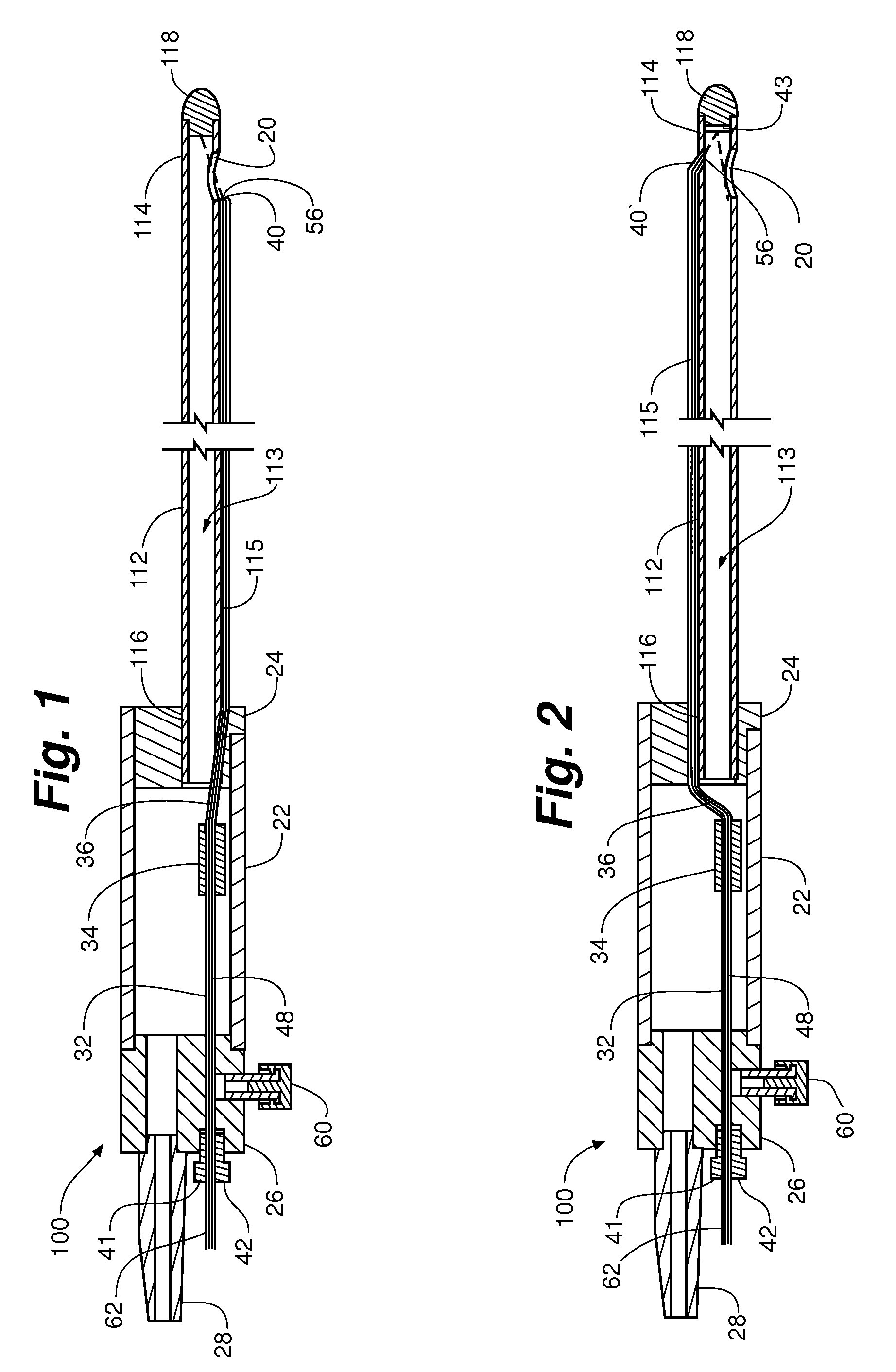 Laser energy device for soft tissue removal