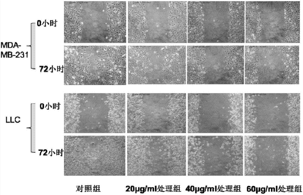 Polypeptide for inhibiting tumor cell diffusion transfer and preparation method and application thereof