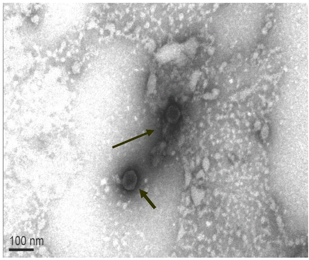 Rice bacterial brown streak germ phage and application thereof