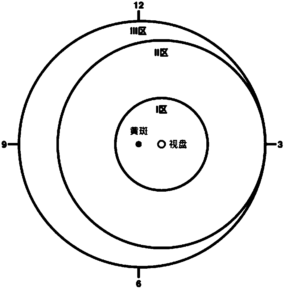 Auto-check method and system of retinopathy of prematurity