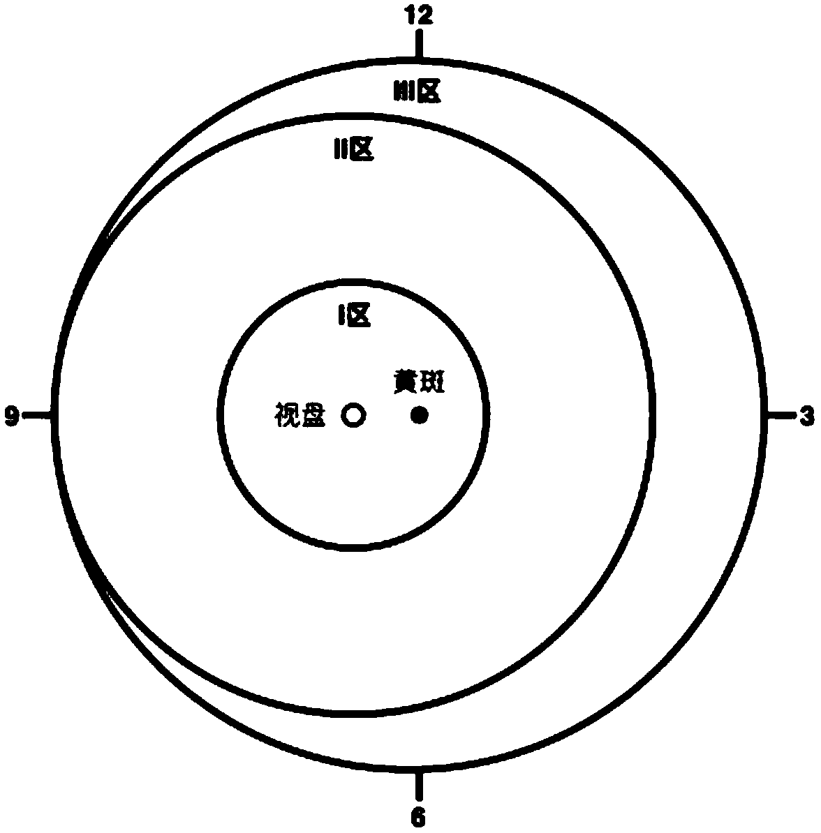 Auto-check method and system of retinopathy of prematurity