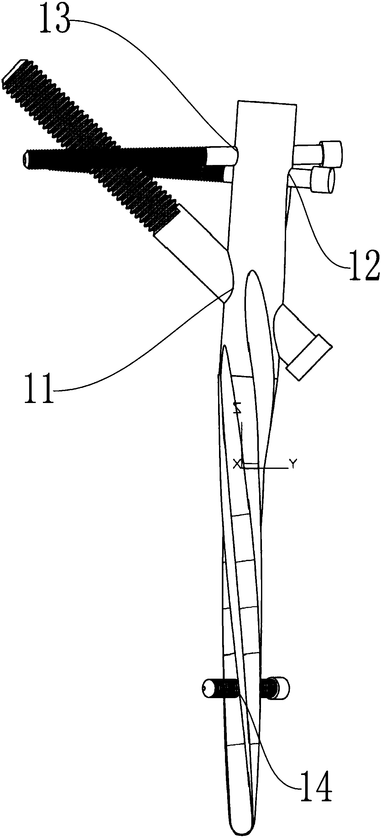 Unreamed intramedullary nail used for treating femur fracture and having minimally invasive and supporting functions