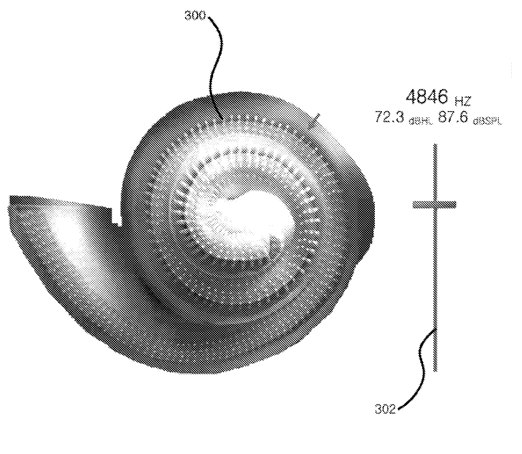 Method and apparatus for hair cell stimulation using acoustic signals