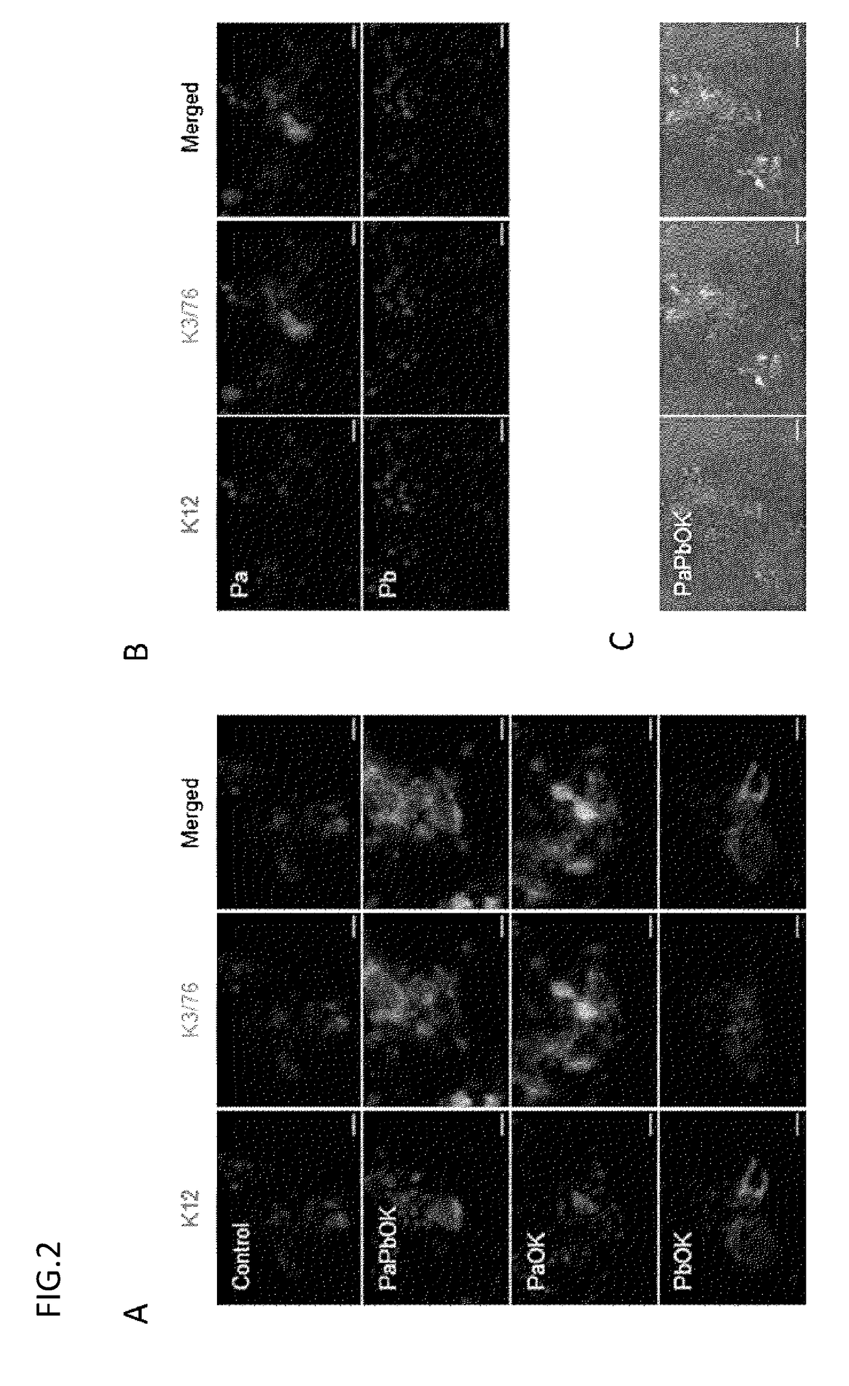 Corneal epithelioid cells derived from surface ectodermal cells