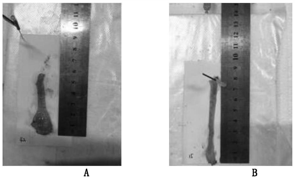 A traditional Chinese medicine composition for treating ulcerative colitis and its preparation method