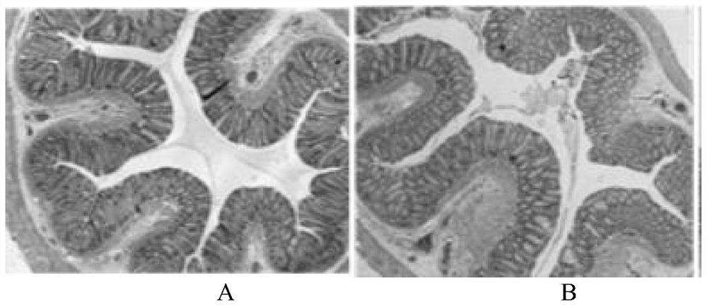 A traditional Chinese medicine composition for treating ulcerative colitis and its preparation method