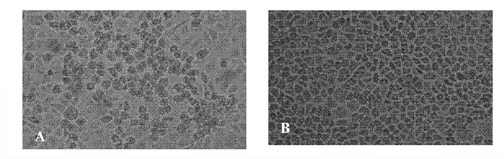 Chinese isolated strain of bovine enterovirus, and construction and application of infectious cDNA clone thereof