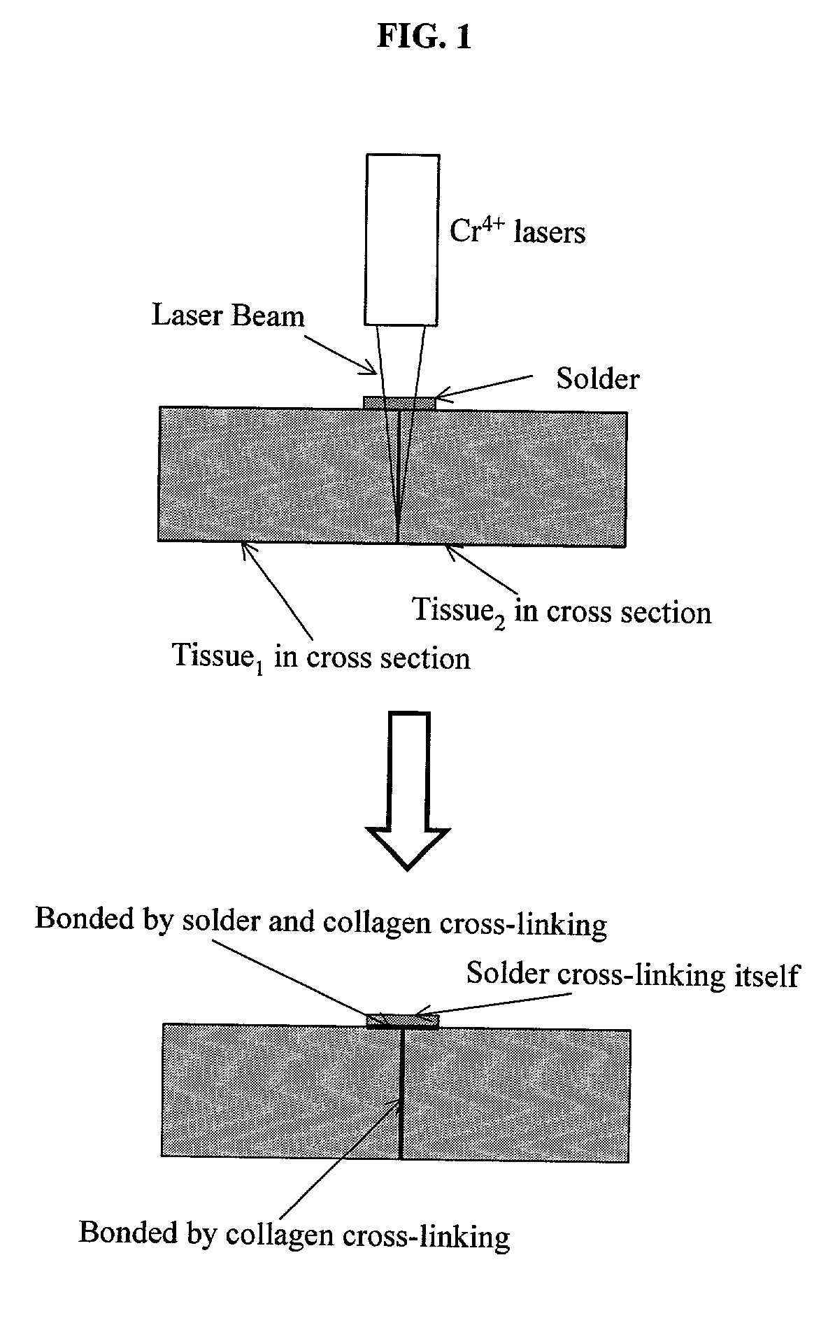 Gelatin based on Power-gel(TM) as solders for Cr4+laser tissue welding and sealing of lung air leak and fistulas in organs