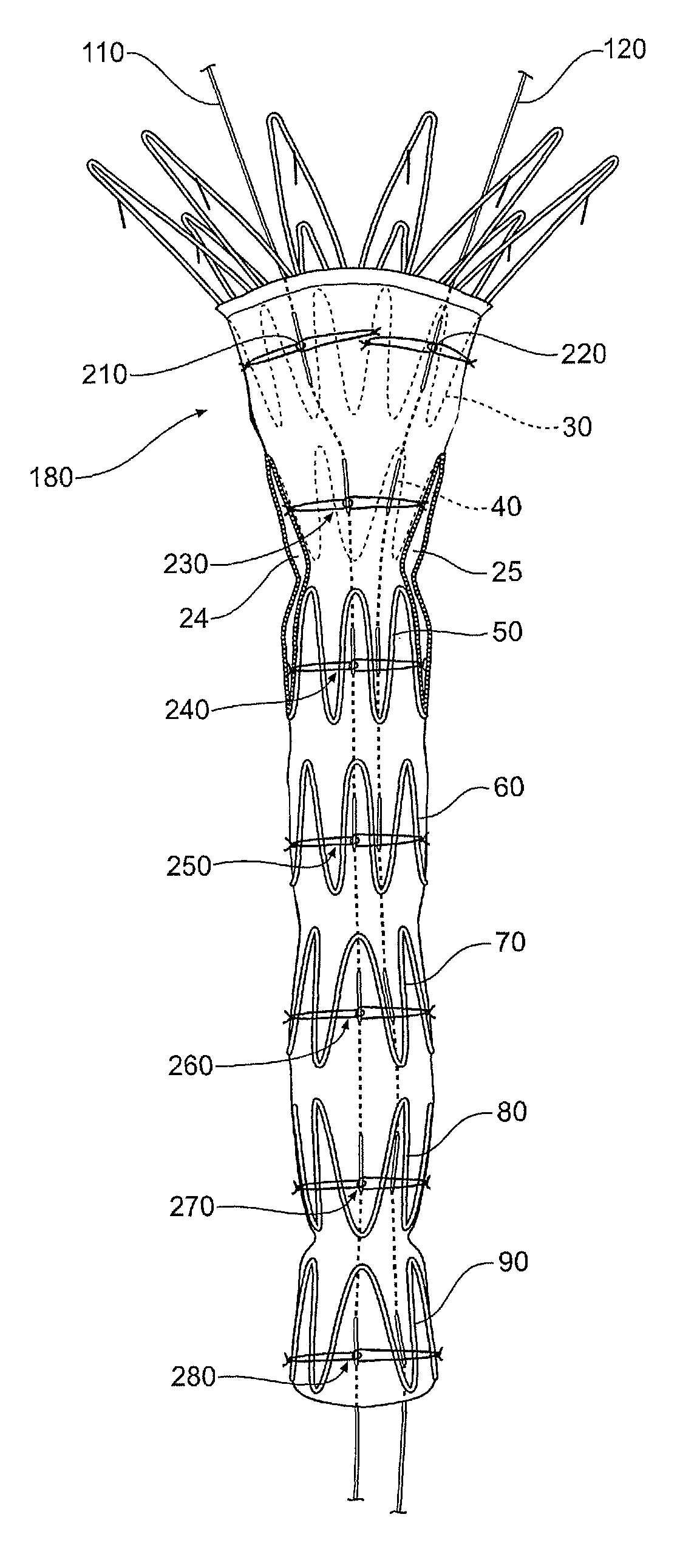 Assembly of stent grafts with diameter reducing ties