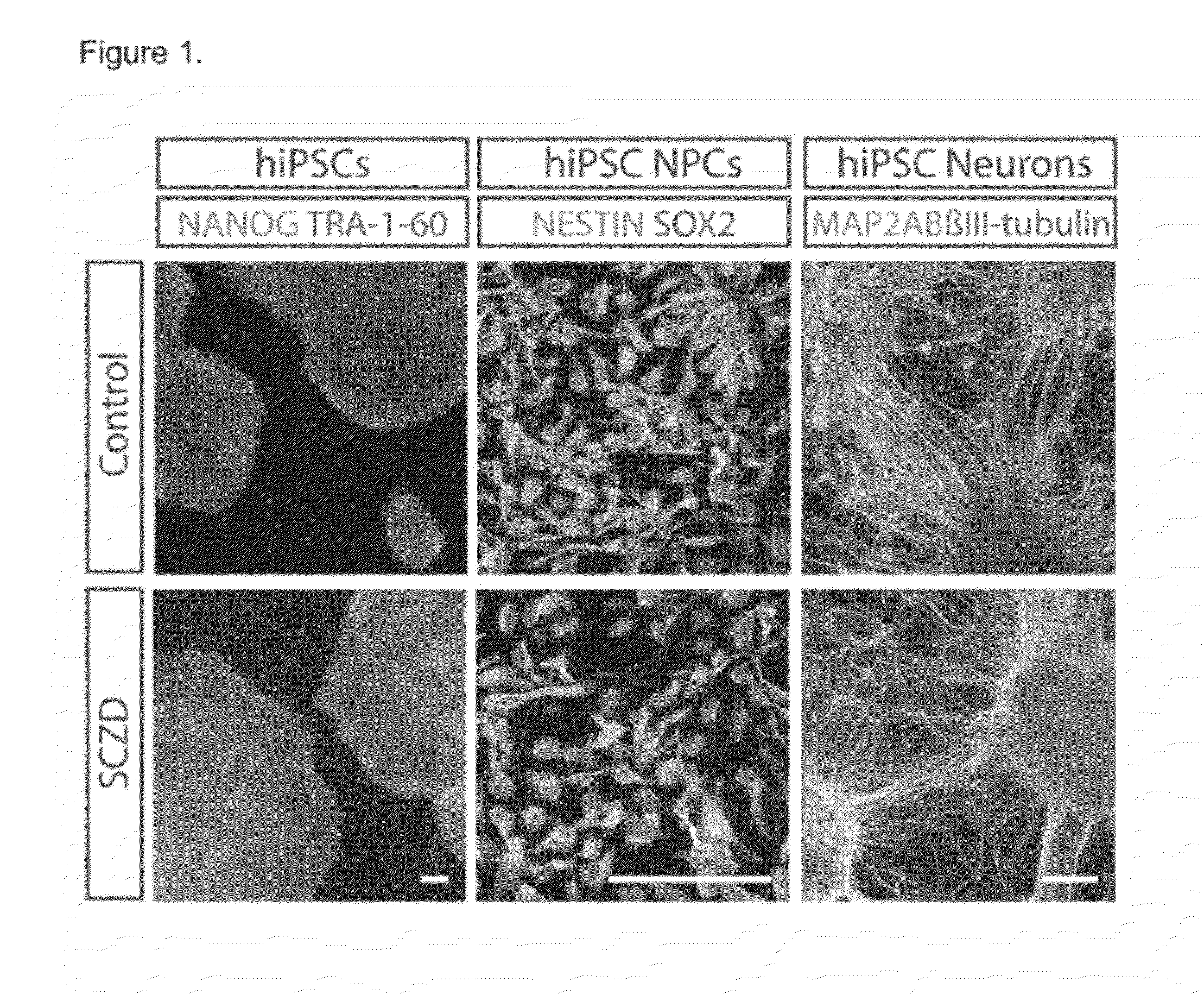 Schizophrenia methods and compositions