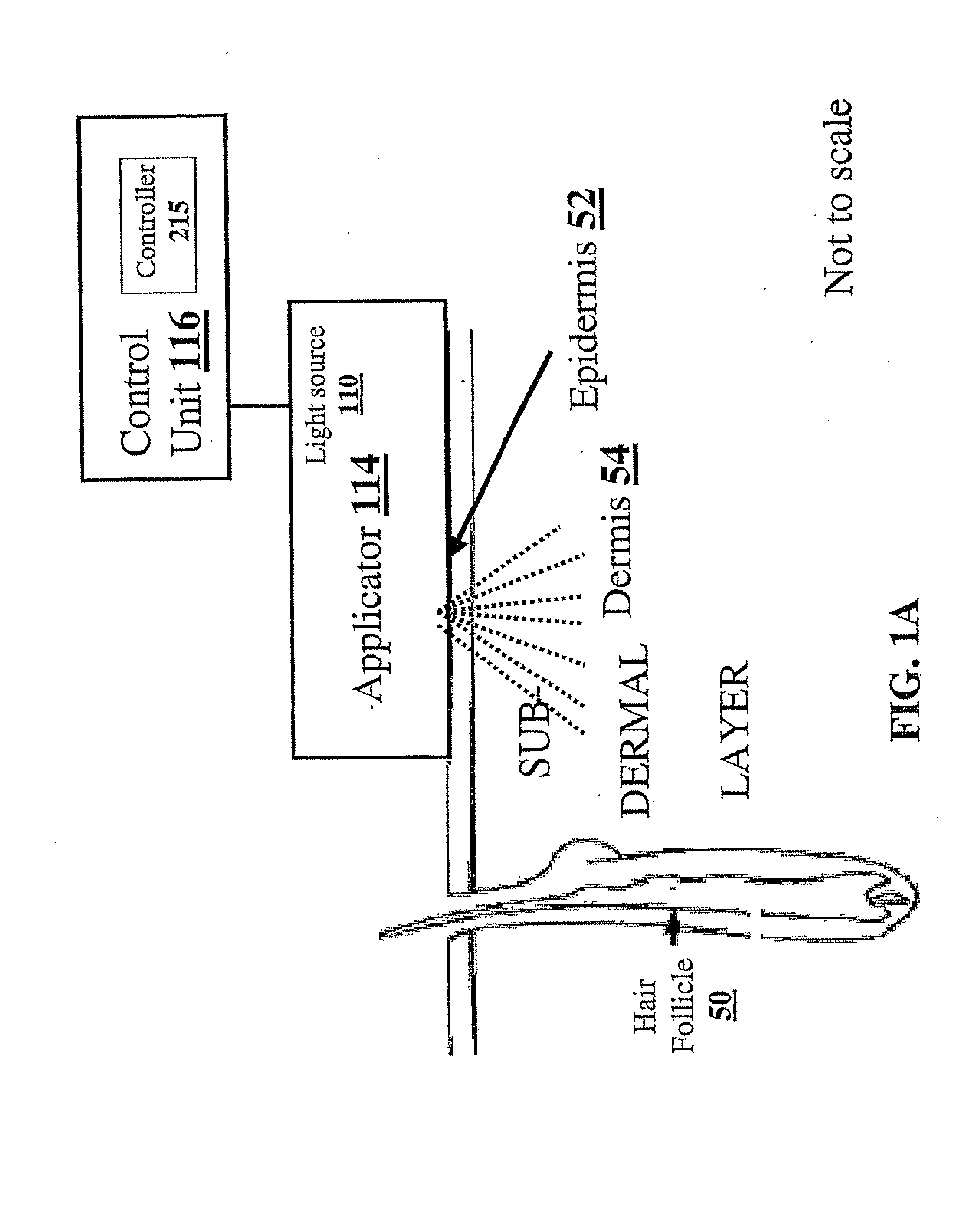 Method and apparatus for light-based hair removal using incoherent light pulses