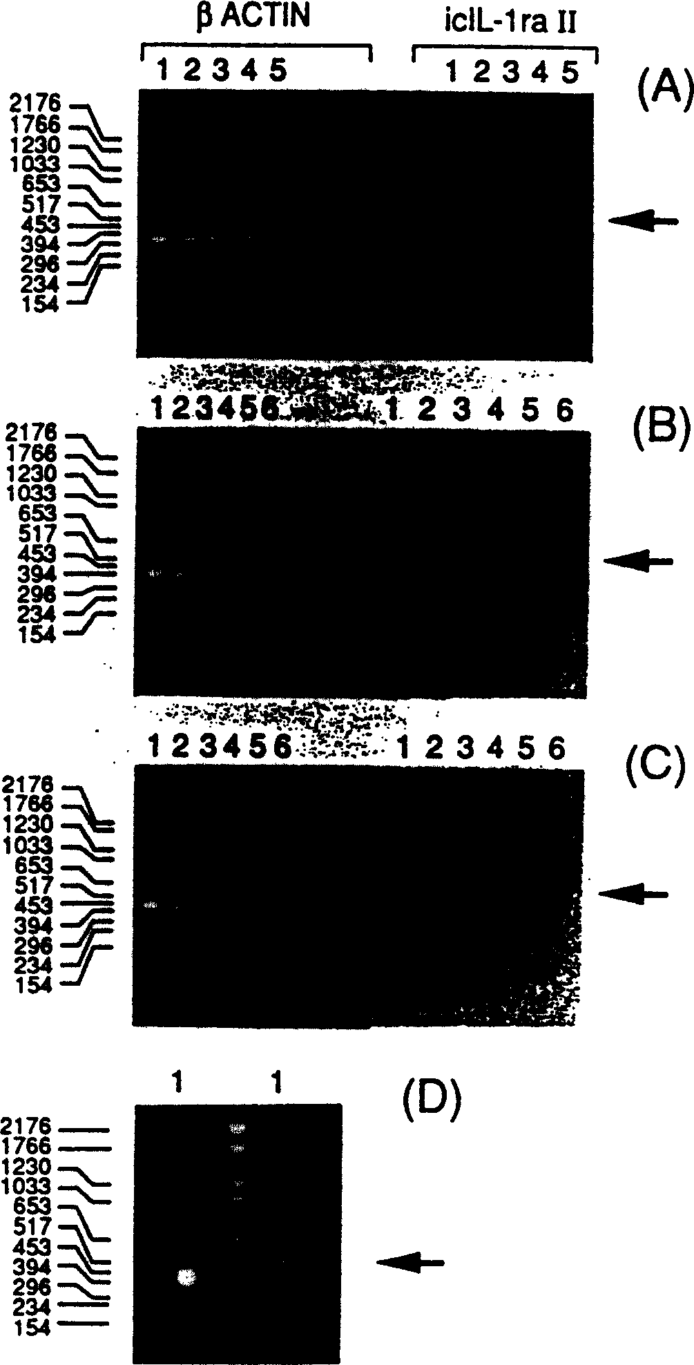 Intracellular isoform of the interleukin-1 receptor antagonist