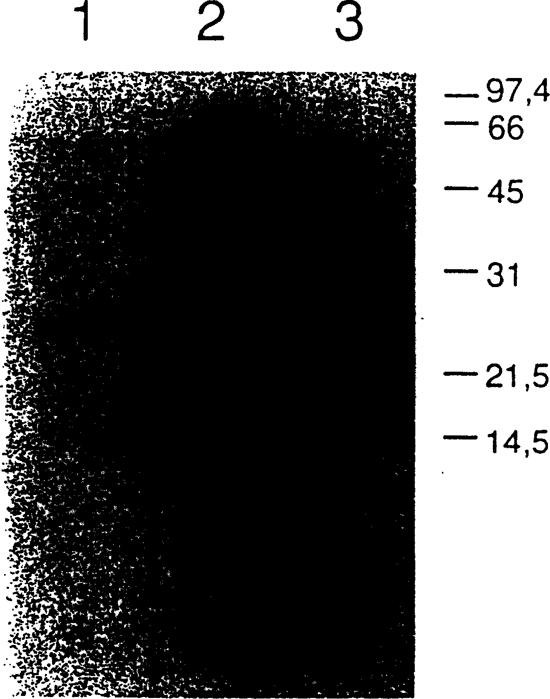 Intracellular isoform of the interleukin-1 receptor antagonist