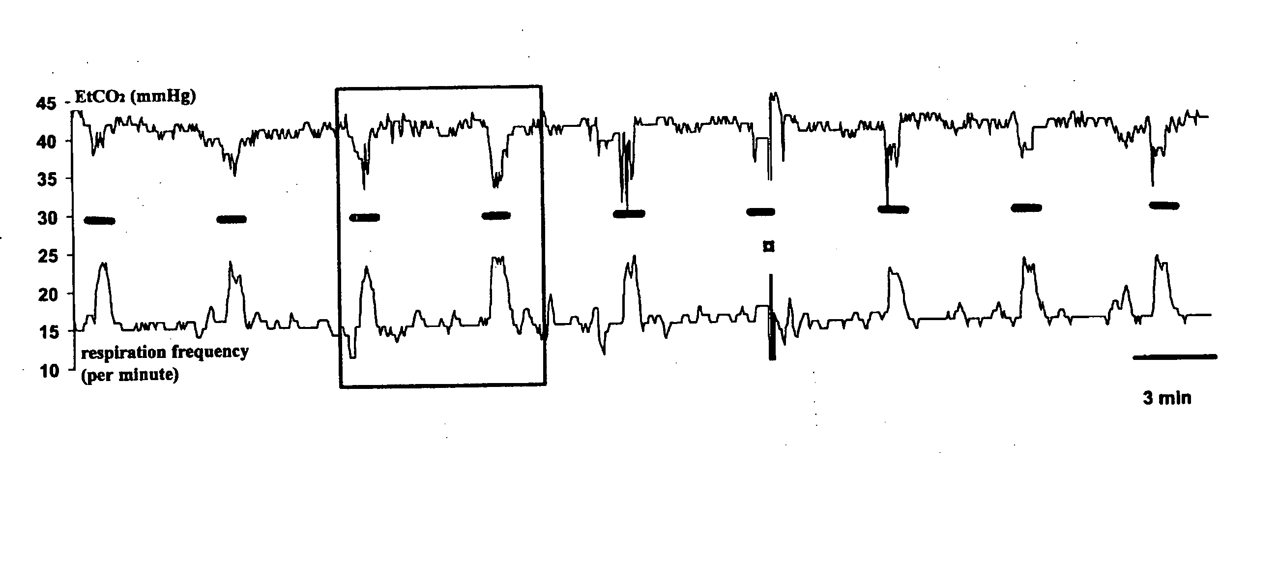 Novel method for the adjustment of human and animal vagus nerve stimulation