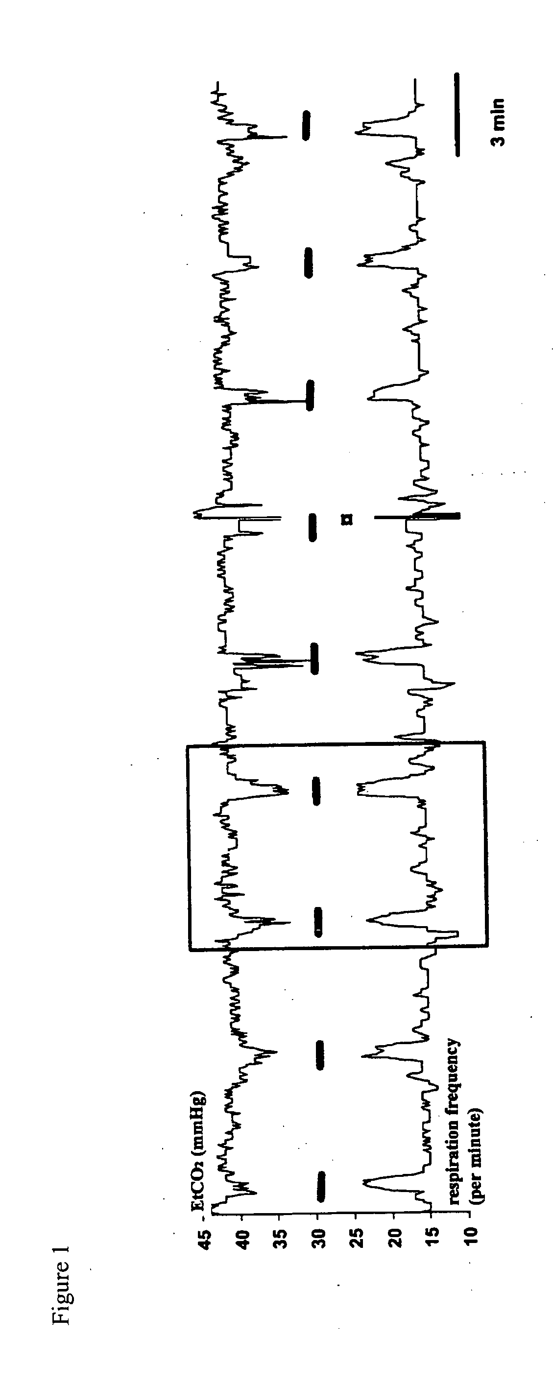 Novel method for the adjustment of human and animal vagus nerve stimulation