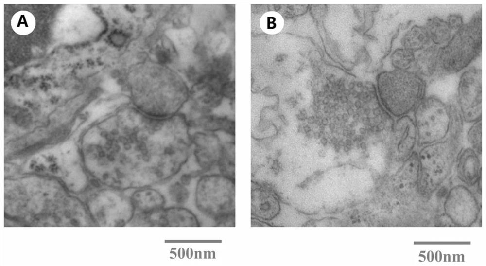 Neuronal synaptic vesicle protein SYN sensitive to terahertz wave radiation