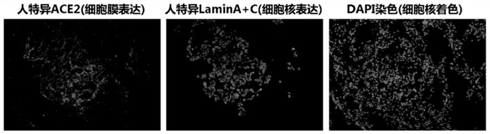 Novel coronavirus SARS-CoV-2 infected rodent model and construction method and application thereof