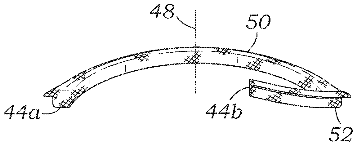 Asymmetric mitral annuloplasty band