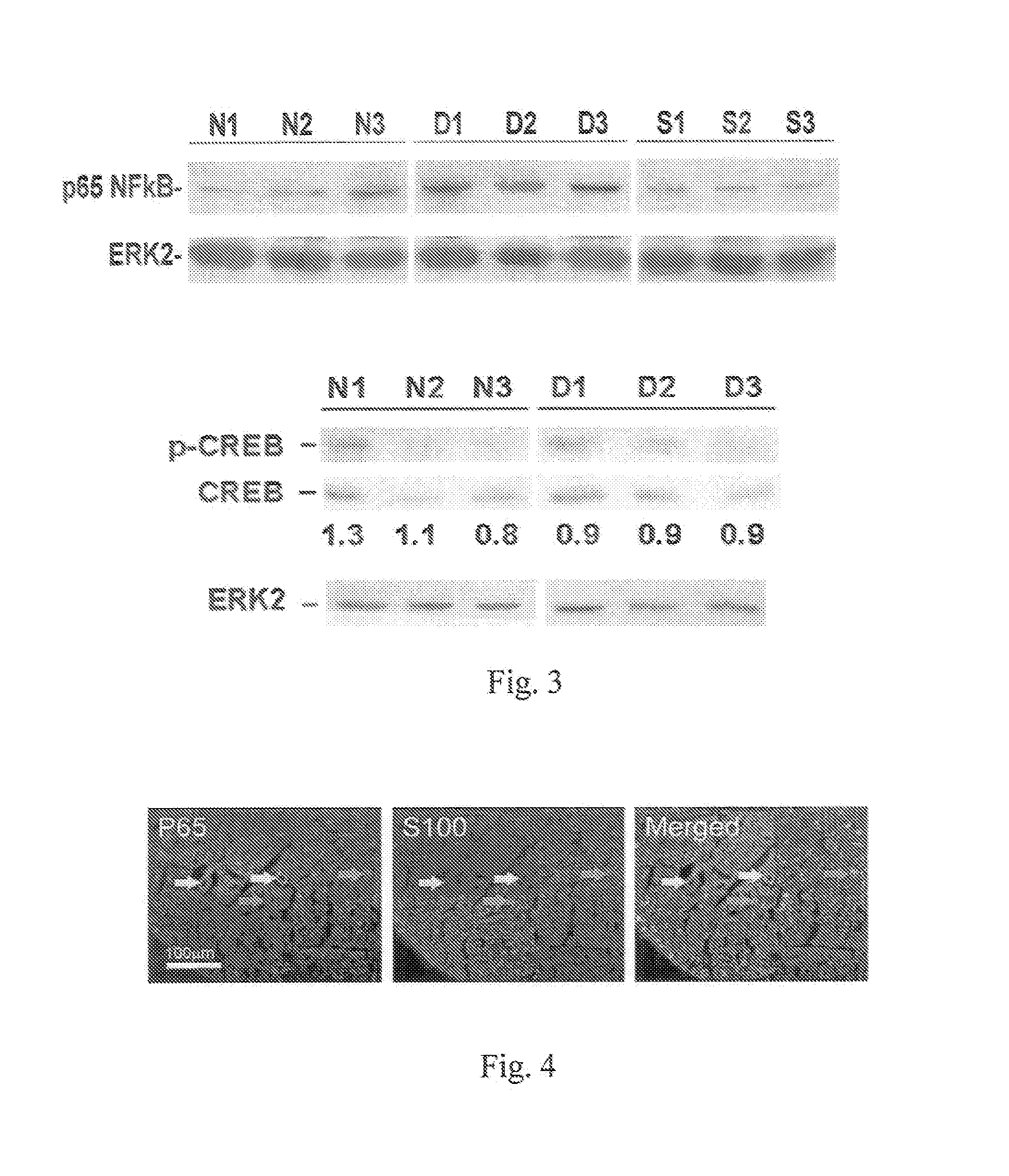 Composition and method of treating peripheral neuropathy