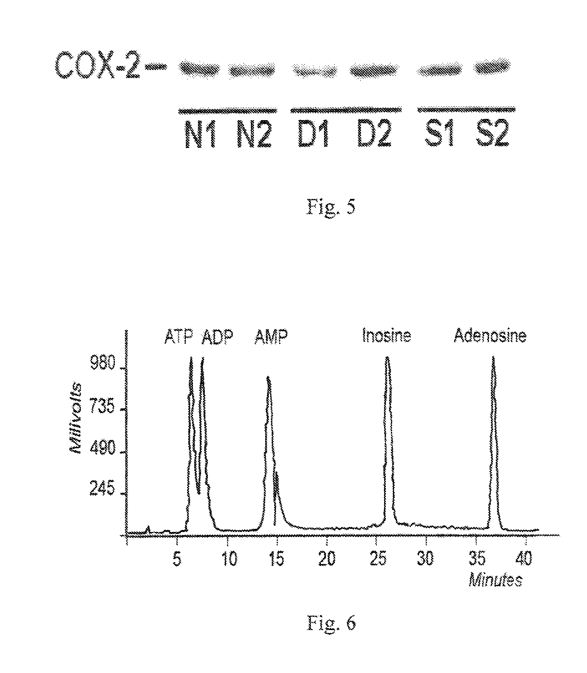 Composition and method of treating peripheral neuropathy