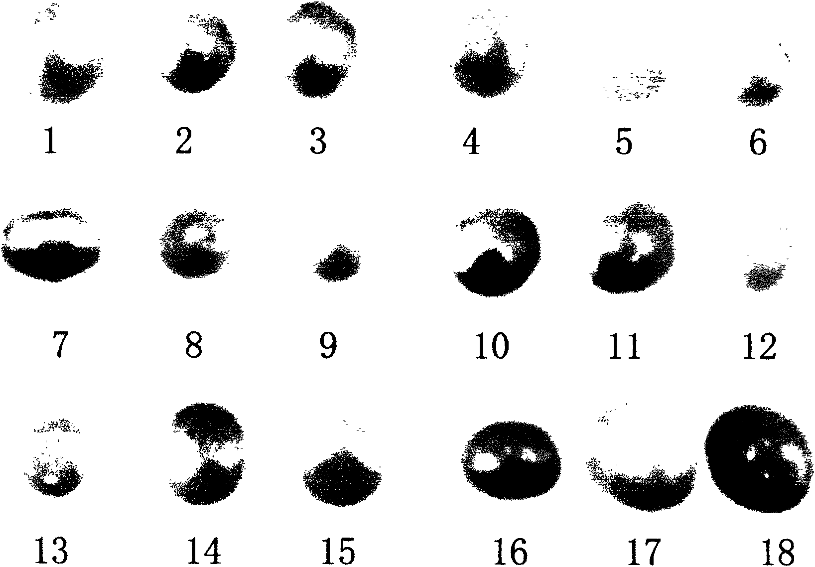 Pearl eosin dyeing method