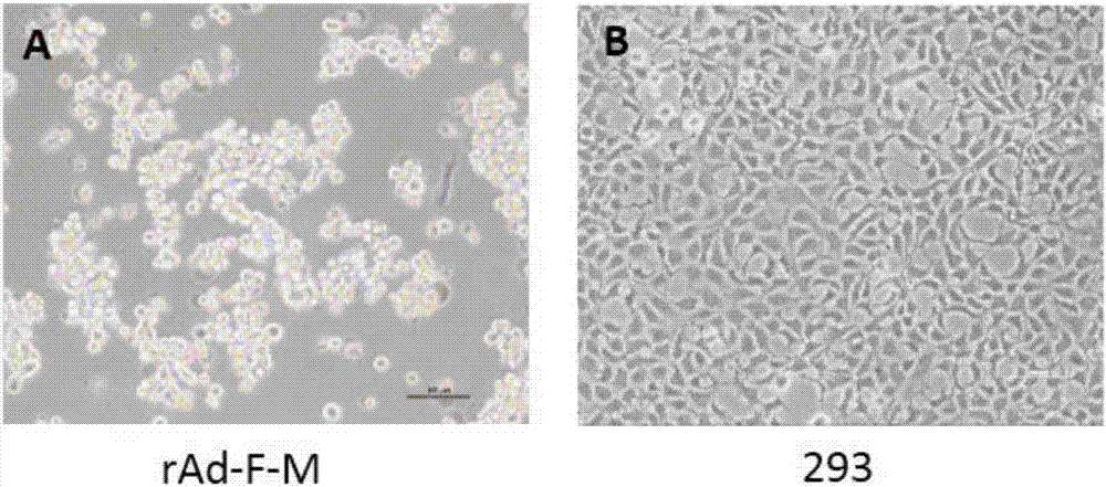 Recombinant adenovirus vector expressed in-vivo self-assembly respiratory syncytial virus-like particle, preparation method and application thereof