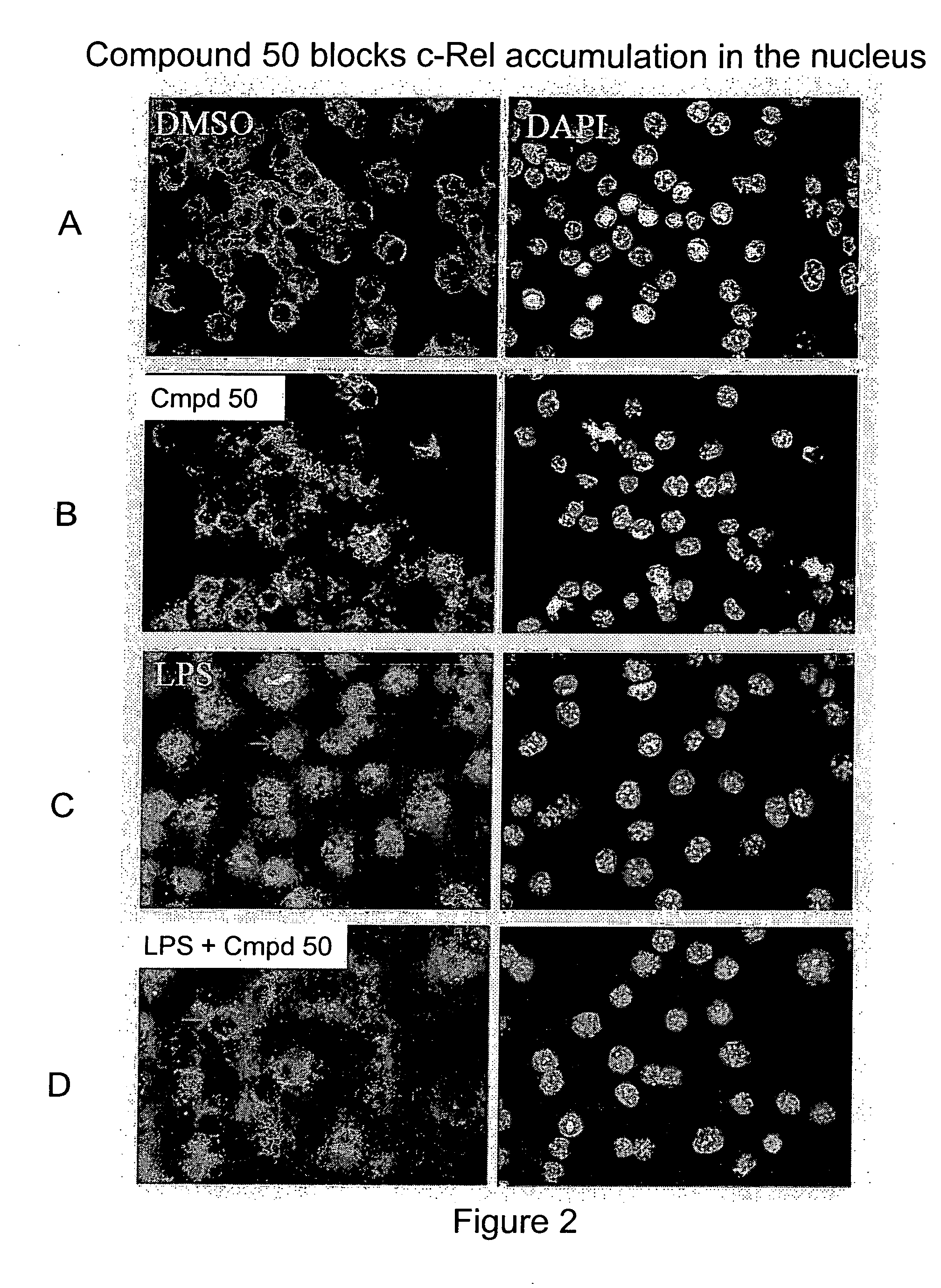 Method for treating B cell regulated autoimmune disorders