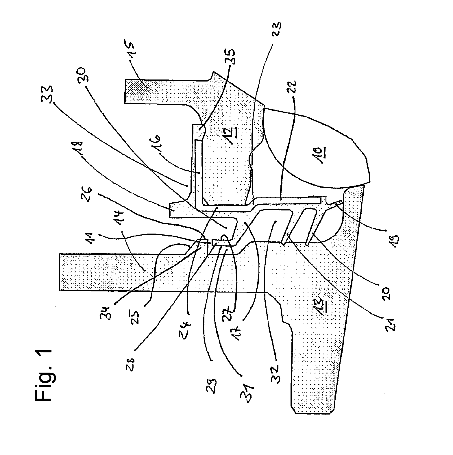 Labyrinth seal of a radial rolling contact bearing having a radial flange