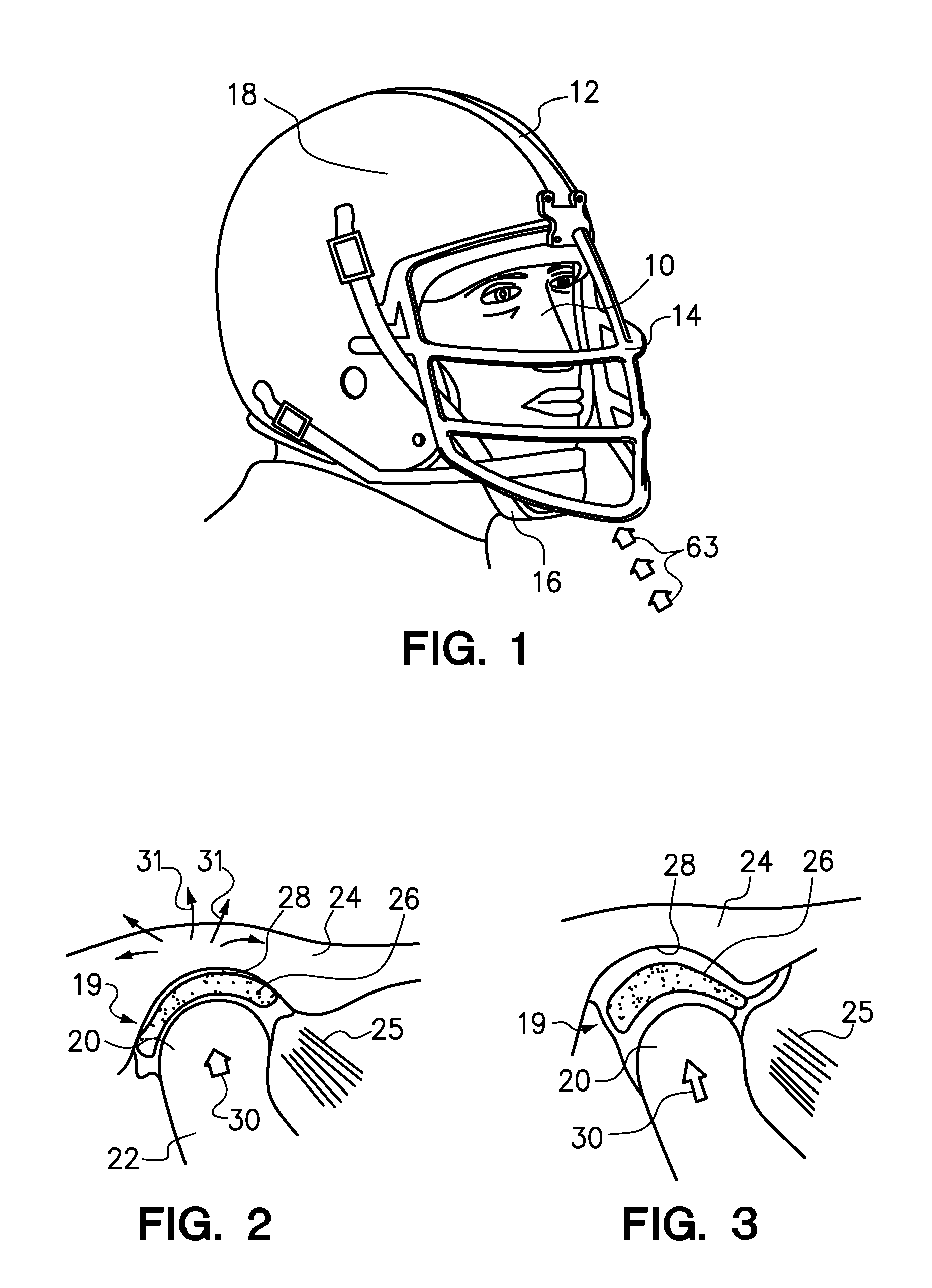 Mouthguard and method of manufacture therefor