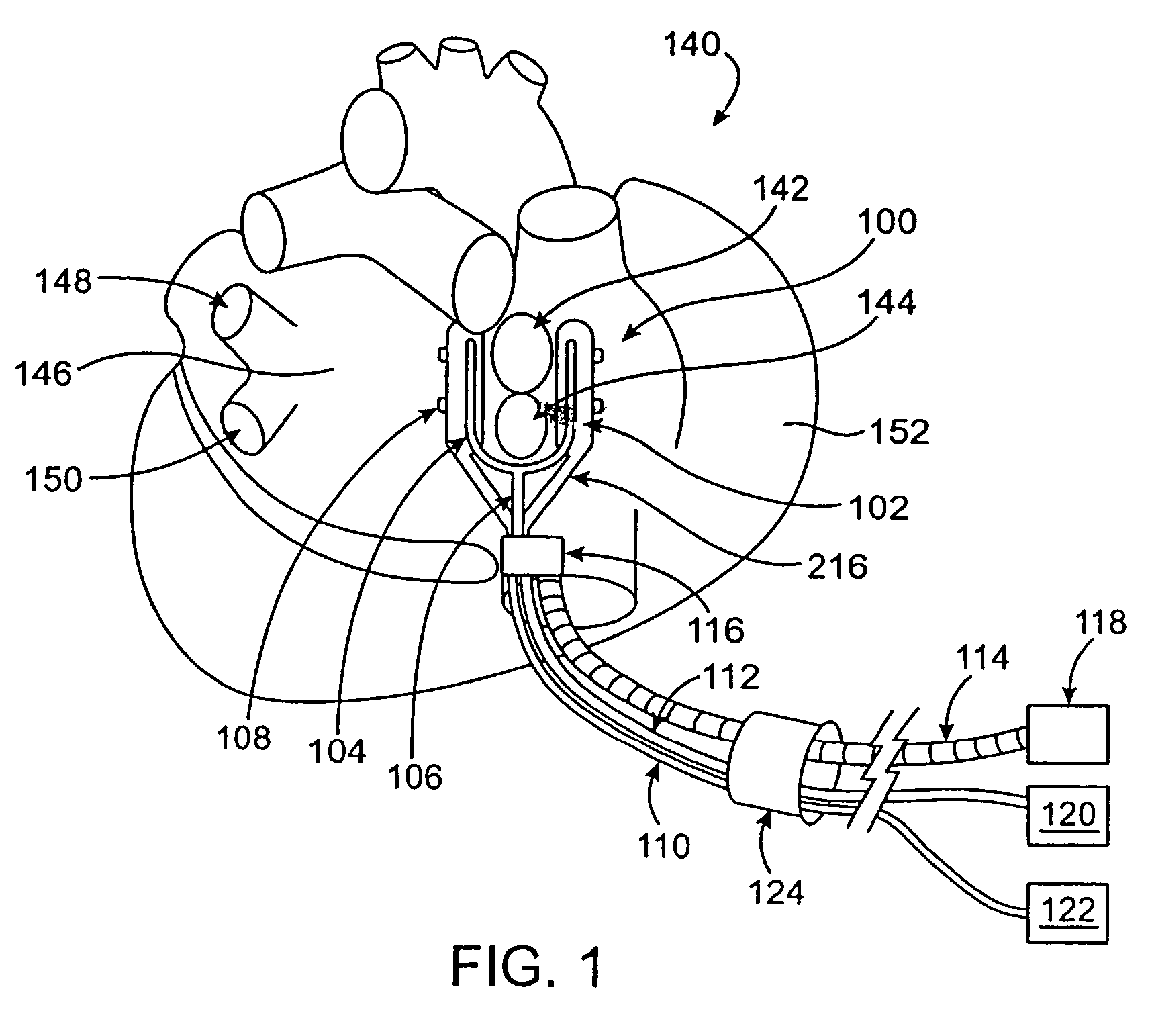 Cardiac ablation devices and methods