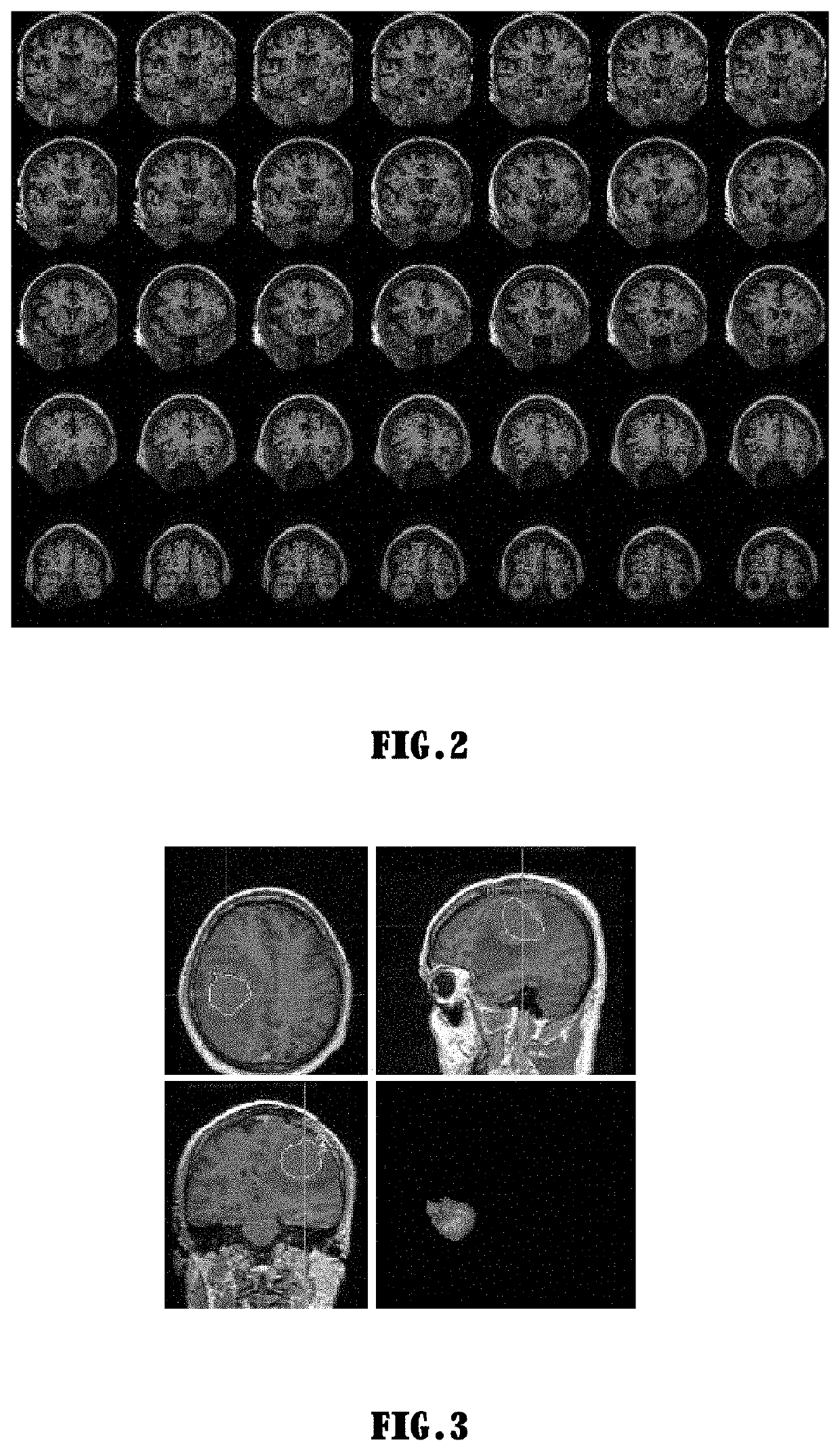 Method for analysing medical treatment data based on deep learning and intelligence analyser thereof