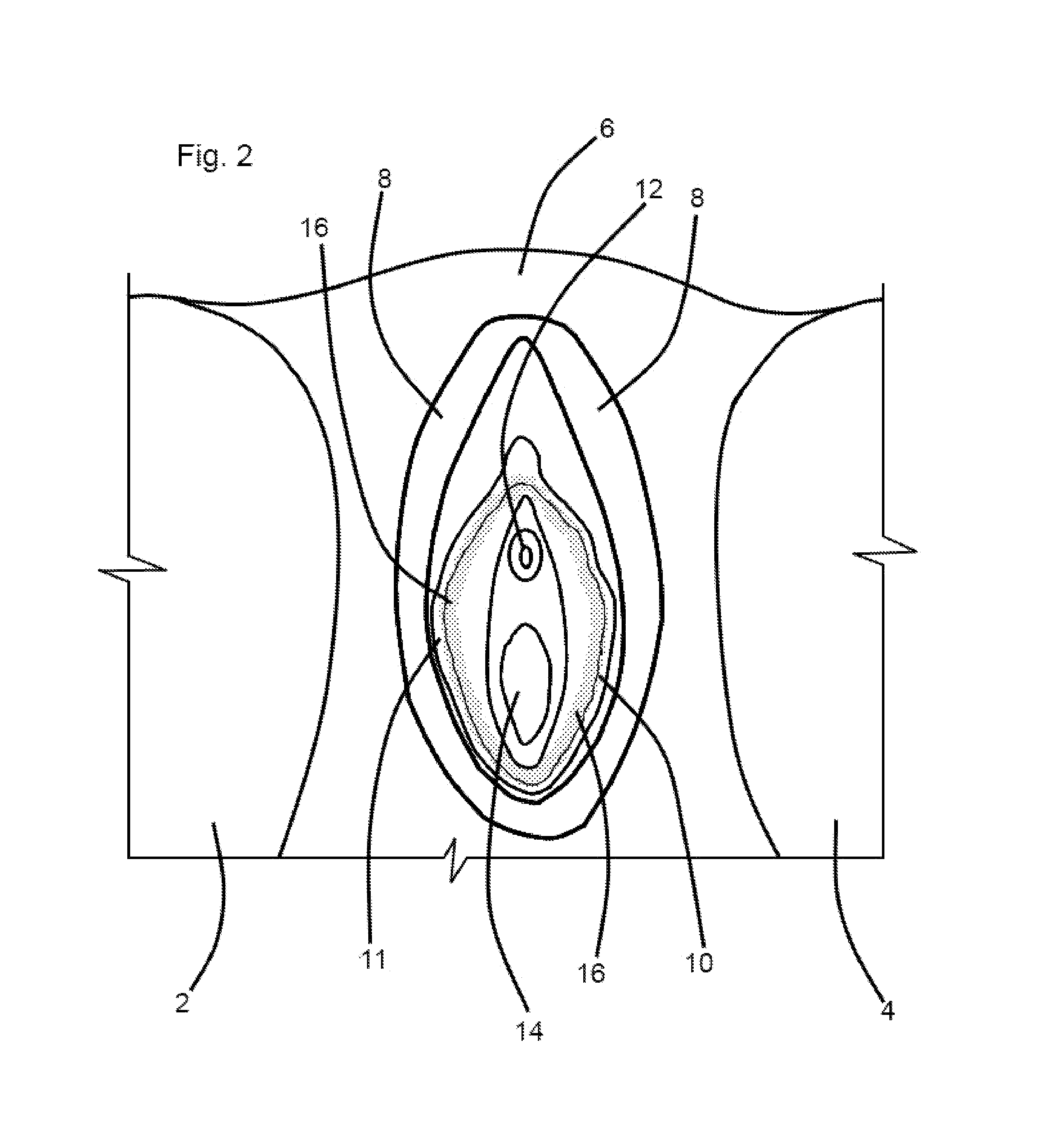 Method for alternatively resisting and permitting menstrual flow