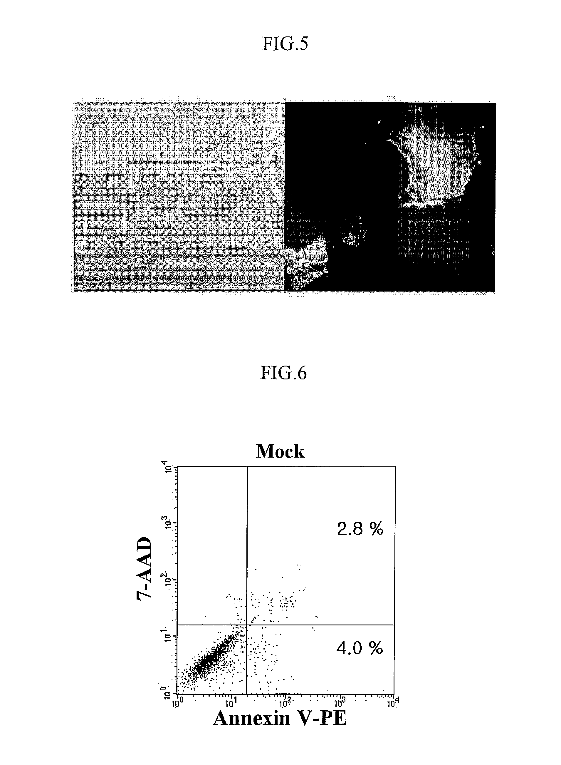 Dendrite Cells Transduced with Recombinant Adenovirus Advcea Which Generate Cea-Specific Cytotoxic T Lymphocytes, Vaccine and Pharmaceutical Composition Comprising the Same