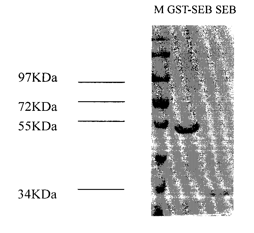 Function epitopes of staphylococcal enterotoxin B (SEB), monoclonal antibodies specifically bound with function epitopes and application of monoclonal antibodies