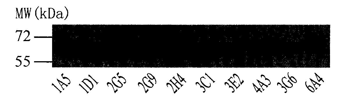 Function epitopes of staphylococcal enterotoxin B (SEB), monoclonal antibodies specifically bound with function epitopes and application of monoclonal antibodies